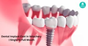 Dental Implants Cost in Velachery