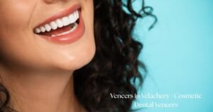Veneers in Velachery